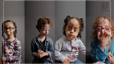 کودکانی با علائم سندروم مارشال|مسیر
