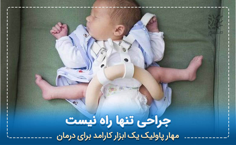 نوزادی که برای درمان شلی مفصل لگن بریس پوشیده|مسیر